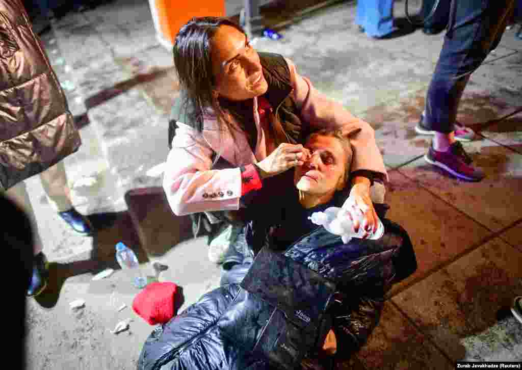 A woman who was affected by tear gas receives aid during the protest.&nbsp; Georgian President Salome Zurabishvili applauded the protesters while on a visit to the United States. &quot;You represent a free&nbsp;Georgia, a&nbsp;Georgia&nbsp;which sees its future in the West, and won&#39;t let anyone to take this future away,&quot; she said in a video address.&nbsp;