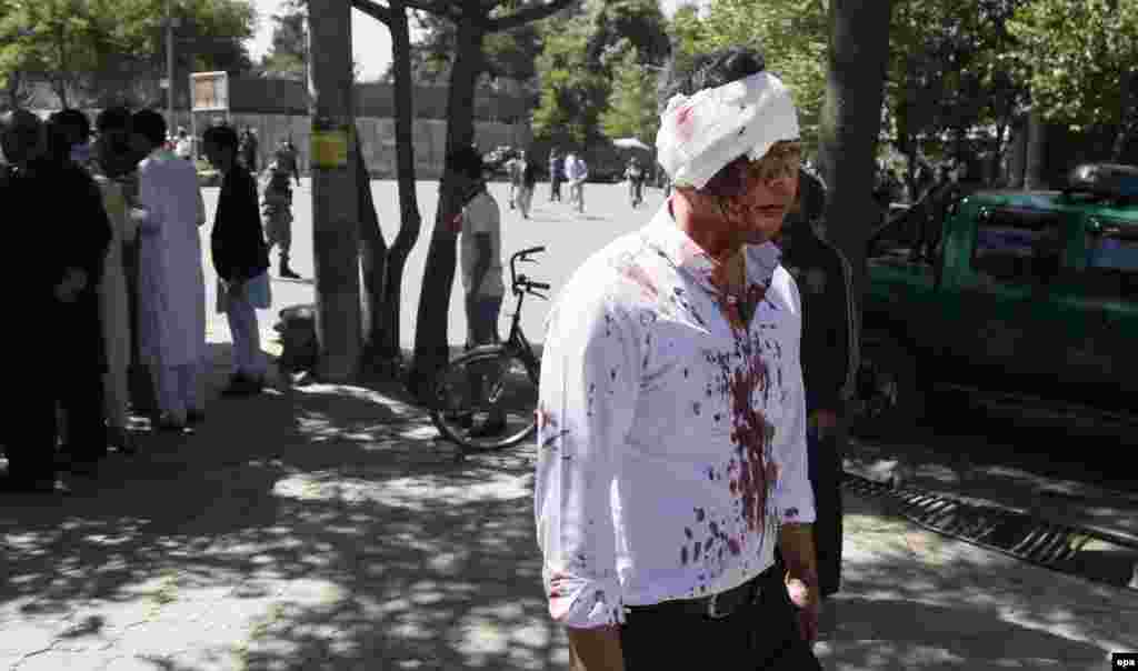 A man who was injured in the blast leaves the scene after getting first aid.