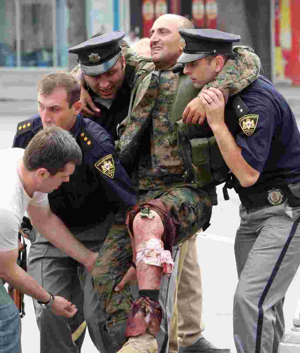 Грузия полицейлері жараланған грузин сарбазын әкетіп бара жатыр.